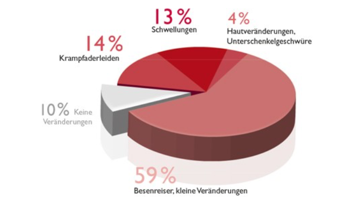 Grafik Venenschwäche Symptome