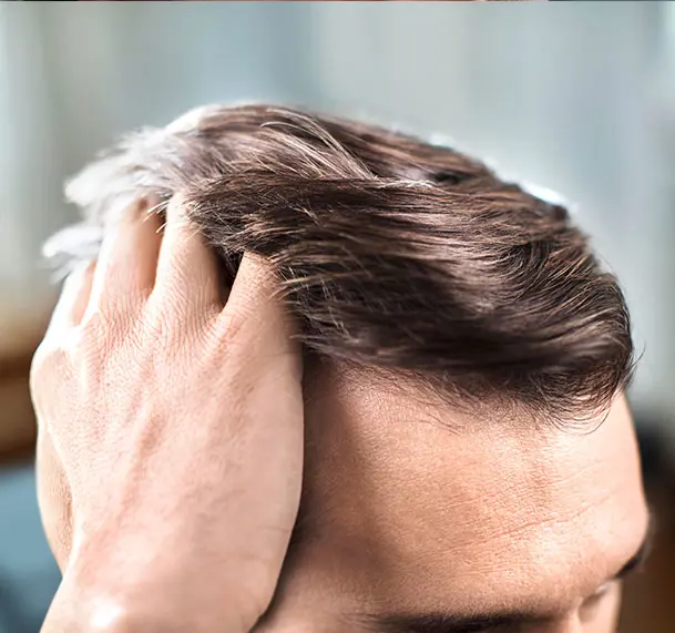 Die Kopfhaut gesund halten