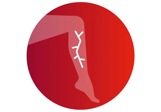 Venenschwäche Symptom Krampfadern