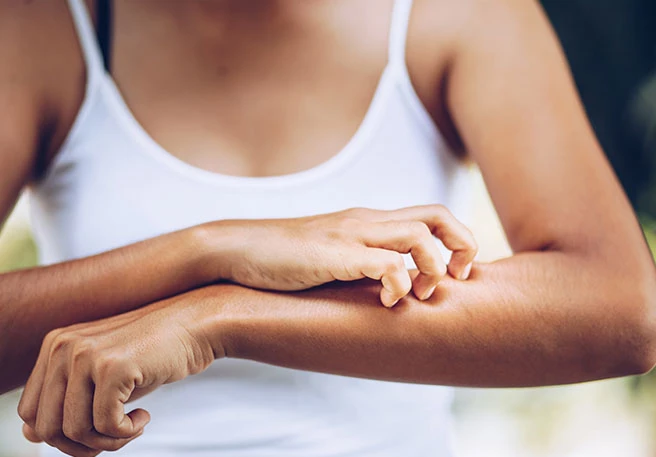 Sonnencreme & Verträglichkeit