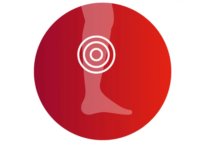 Venenschwäche Symptom Beinödeme